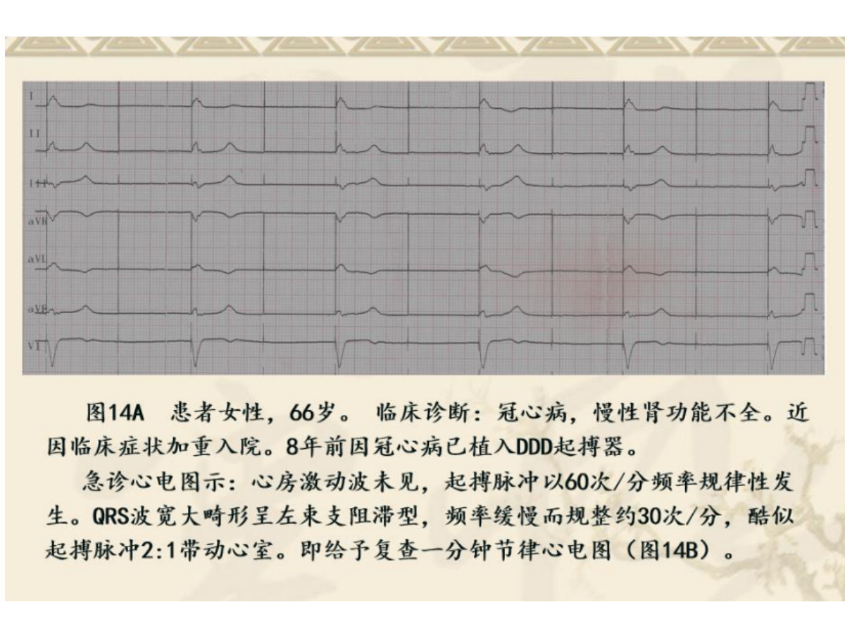 选择正确的电机：驱动电机与伺服电机性能比较 (选择正确的电话拨打时间)